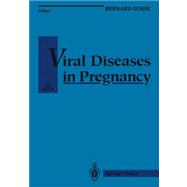 Viral Diseases in Pregnancy