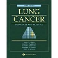 Lung Cancer Principles and Practice