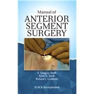 Manual of Antterior Segment Surgery