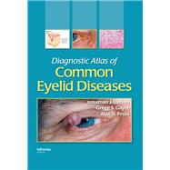 Diagnostic Atlas of Common Eyelid Diseases