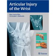 Articular Injury of the Wrist