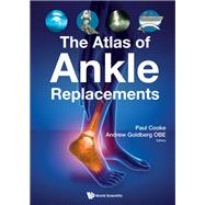The Atlas of Ankle Replacements