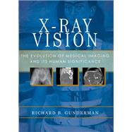 X-Ray Vision The Evolution of Medical Imaging and Its Human Significance