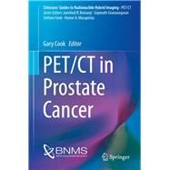 Pet/Ct in Prostate Cancer
