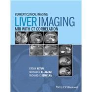 Liver Imaging MRI with CT Correlation