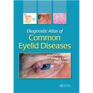 Diagnostic Atlas of Common Eyelid Diseases