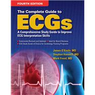 The Complete Guide to ECGs