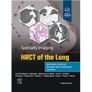Specialty Imaging: HRCT of the Lung,9780443286360