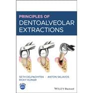 Principles of Dentoalveolar Extractions