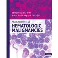 Management of Hematologic Malignancies