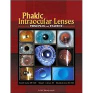 Phakic Intraocular Lenses Principles and Practice