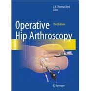 Operative Hip Arthroscopy