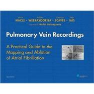 Pulmonary Vein Recordings