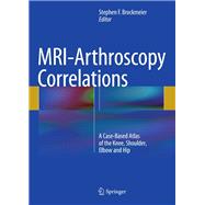 Mri-arthroscopy Correlations