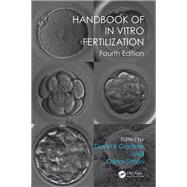 Handbook of In Vitro Fertilization