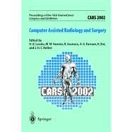 CARS 2002 Computer Assisted Radiology and Surgery Proceedings of the 16th International Congress and Exhibition Paris, June 26-29, 2002