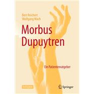 Morbus Dupuytren