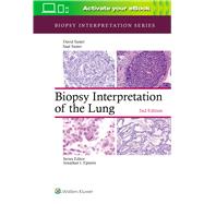 Biopsy Interpretation of the Lung