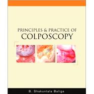 Principles and Practice of Colposcopy