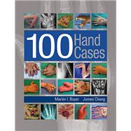 100 Hand Cases