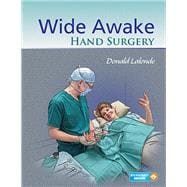 Wide Awake Hand Surgery