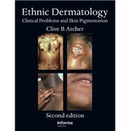 Ethnic Dermatology