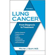 Lung Cancer From Diagnosis to Treatment