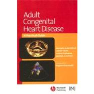 Adult Congenital Heart Disease : A Practical Guide