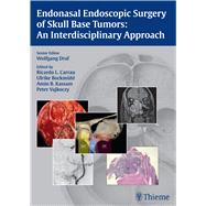 Endonasal Endoscopic Surgery of Skull Base Tumors: An Interdisciplinary Approach
