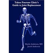 Tahoe Fracture Clinic's Guide to Joint Replacement