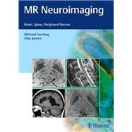 MR Neuroimaging