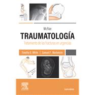 McRae. Traumatología. Tratamiento de las fracturas en urgencias
