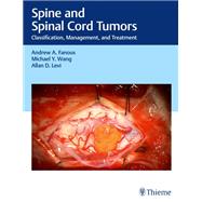 Spine and Spinal Cord Tumors