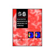 Magnetic Resonance Imaging in Stroke