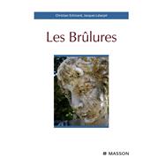 Les brûlures