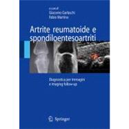 Artrite Reumatoide E Spondiloentesoartriti