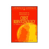 Felson's Principles of Chest Roentgenology : A Programmed Text
