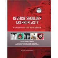 Reverse Shoulder Arthroplasty