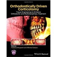 Orthodontically Driven Corticotomy Tissue Engineering to Enhance Orthodontic and Multidisciplinary Treatment