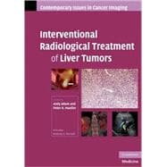 Interventional Radiological Treatment of Liver Tumors