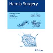 Hernia Surgery