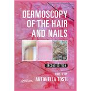 Dermoscopy of the Hair and Nails