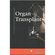 Organ Transplants