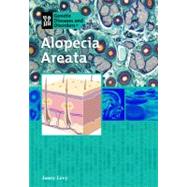 Alopecia Areata