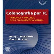 Colonografía por TC: Principios y práctica de la colonoscopia virtual