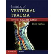 Imaging of Vertebral Trauma