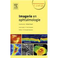 Imagerie En Ophtalmologi