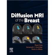 DIFFUSION MRI OF THE BREAST