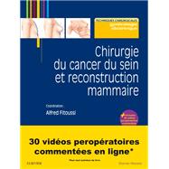 Chirurgie du cancer du sein et reconstruction mammaire