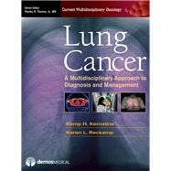 Lung Cancer: A Multidisciplinary Approach to Diagnosis and Management